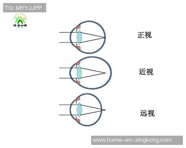 近视眼患者如何安全踢足球提升运动表现与保护视力的有效方法